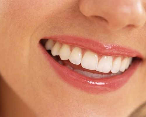 denti 2 denti 2